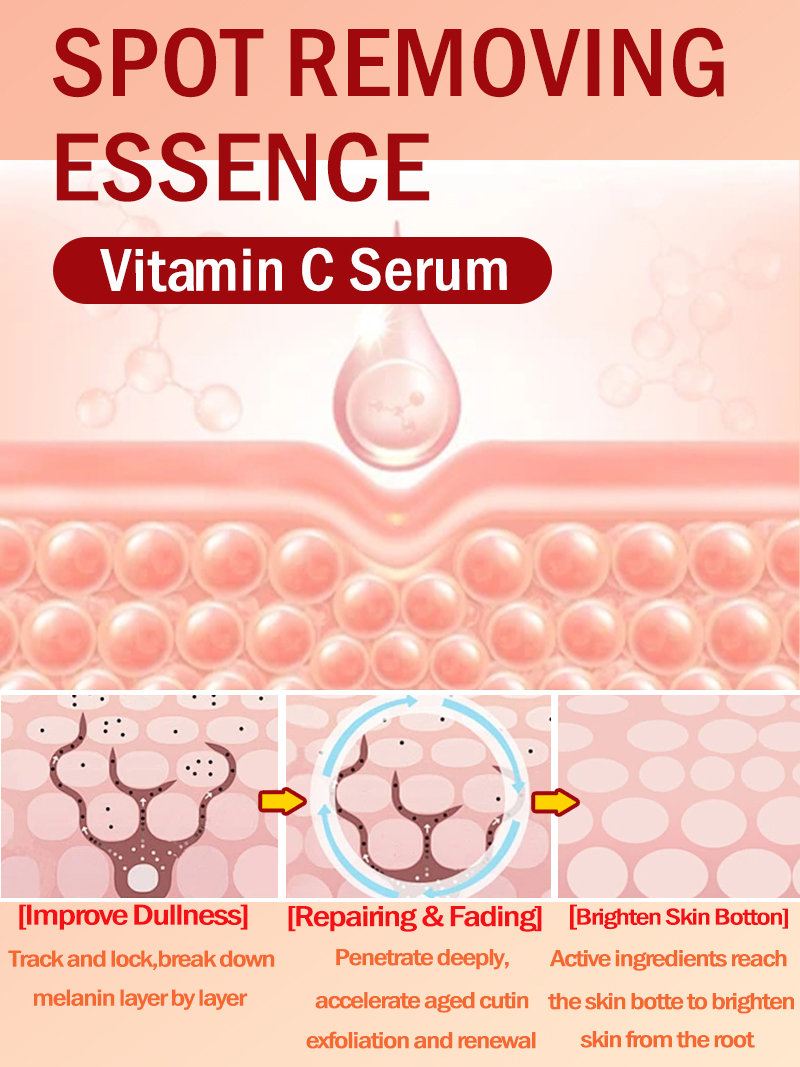 Mencerahkan Bintik-Bintik, Mel - Luxury Skincare Essence ulasan dan harga